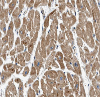 MB Mouse Monoclonal Antibody