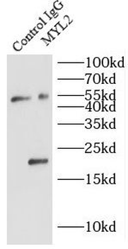 MYL2 Antibody