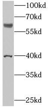 N4BP3 Antibody