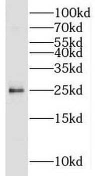 EEF1AKMT1 Antibody
