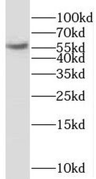 NAB2 Antibody