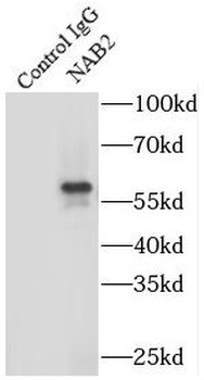 NAB2 Antibody