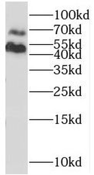 NAGA Antibody