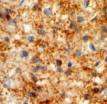 NAGA Antibody