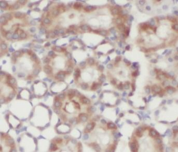 NAGK Antibody