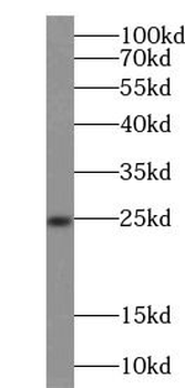 NANOS3 Rabbit Polyclonal Antibody