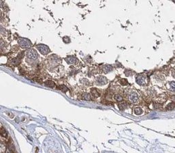 NANOS3 Rabbit Polyclonal Antibody