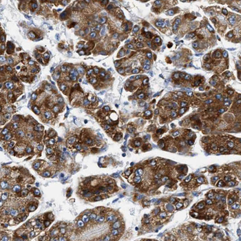 NARS1 Antibody