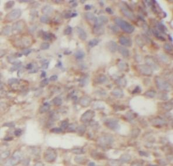 NAT1 Antibody