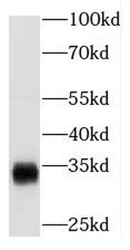 NAT1 Antibody