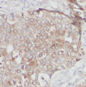 NAT1 Antibody