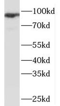 NBN Antibody