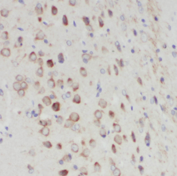 CDH2 Antibody