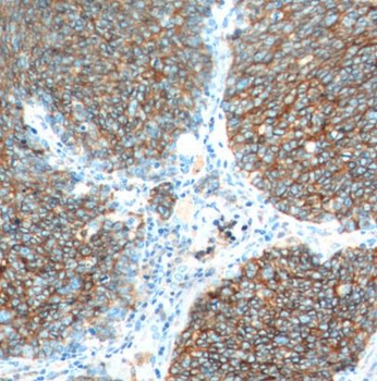 NCAM1 Mouse Monoclonal Antibody