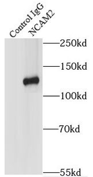 NCAM2 Antibody