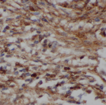 NCAPH Antibody