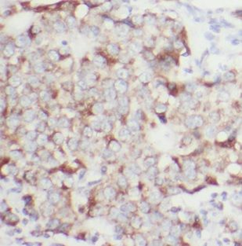 NCKIPSD Antibody