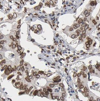 NCOA3 Antibody
