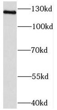 NCOA7 Rabbit Polyclonal Antibody
