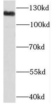 NCOR1 Antibody