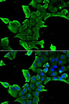 NCS1 Antibody