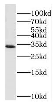 MT-ND1 Antibody