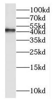 MT-ND2 Antibody