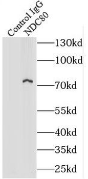 NDC80 Antibody