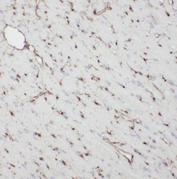 NDC80 Antibody