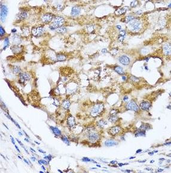 NDE1 Antibody