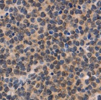 NDOR1 Antibody