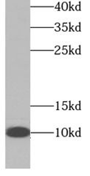 NDUFA4L2 Antibody