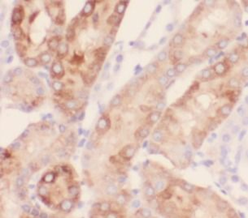 NDUFA4L2 Antibody