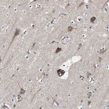 NDUFA5 Antibody