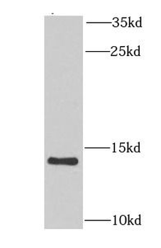 NDUFA6 Antibody