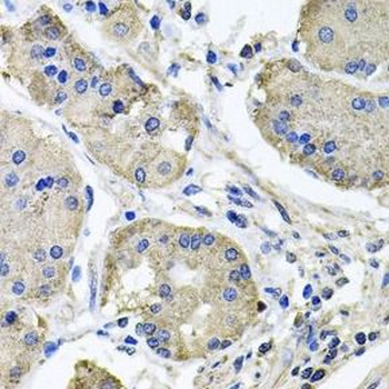 NDUFA6 Antibody
