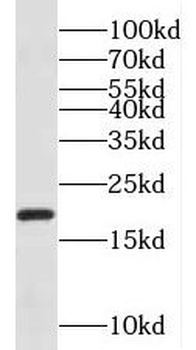 NDUFA8 Antibody