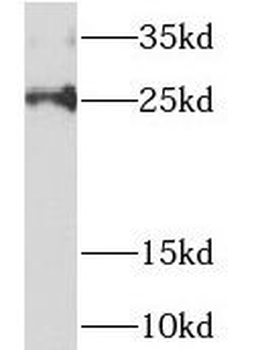 NDUFAF2 Antibody
