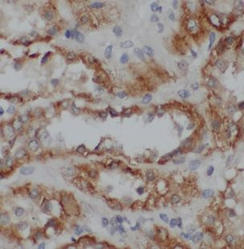 NDUFB1 Antibody
