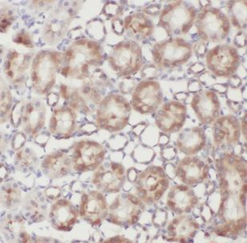 NDUFB11 Antibody