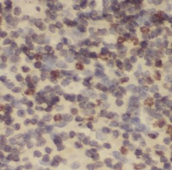NDUFB2 Antibody