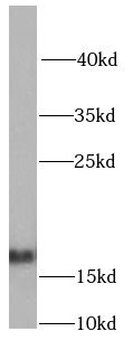 NDUFB5 Antibody