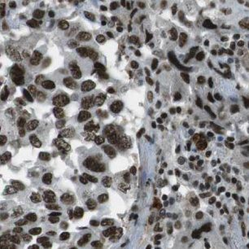 NDUFB5 Antibody