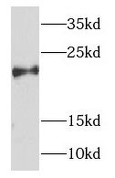 NDUFB7 Antibody