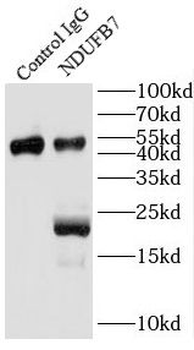 NDUFB7 Antibody