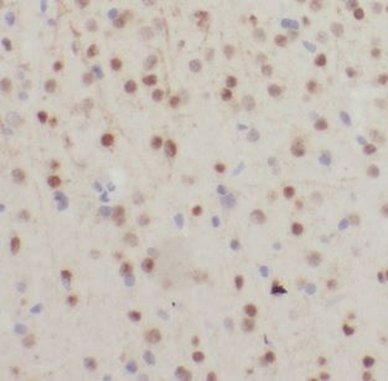 NDUFB7 Antibody