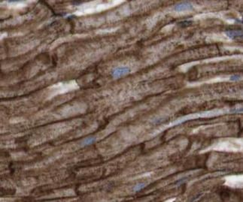 NDUFB8 Antibody