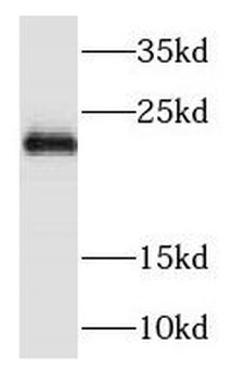 NDUFB9 Rabbit Polyclonal Antibody