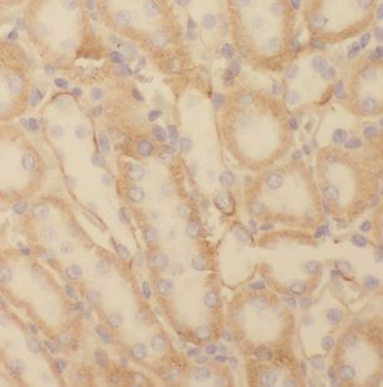 NDUFC2 Antibody