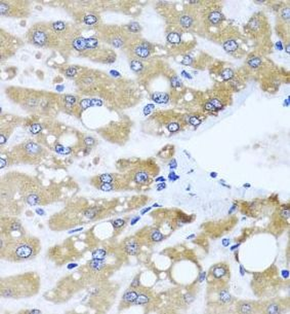 NDUFS3 Antibody
